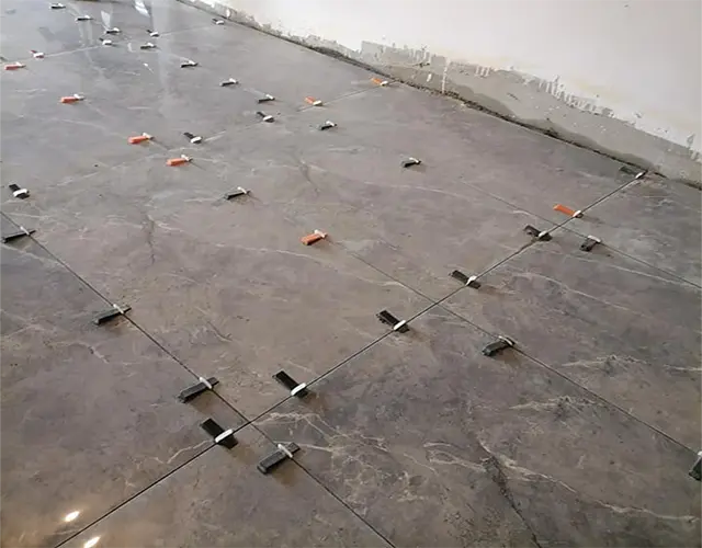 ,تركيب البورسلين بالمشابك